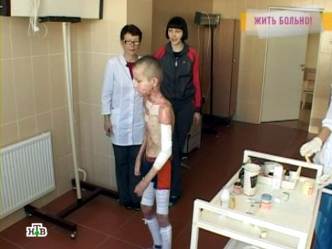 Неврозы симптомы у взрослых лечение форум