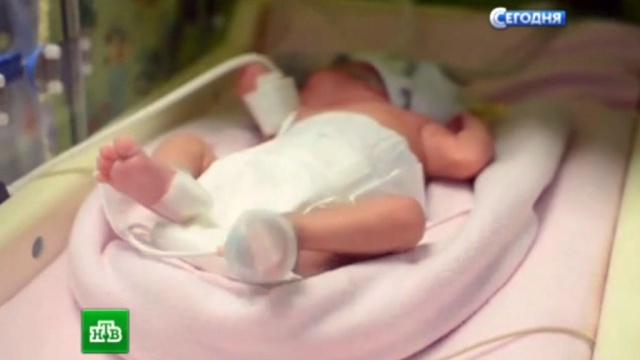Роды при мертвом ребенке видео Роды при мертвом ребенке видео