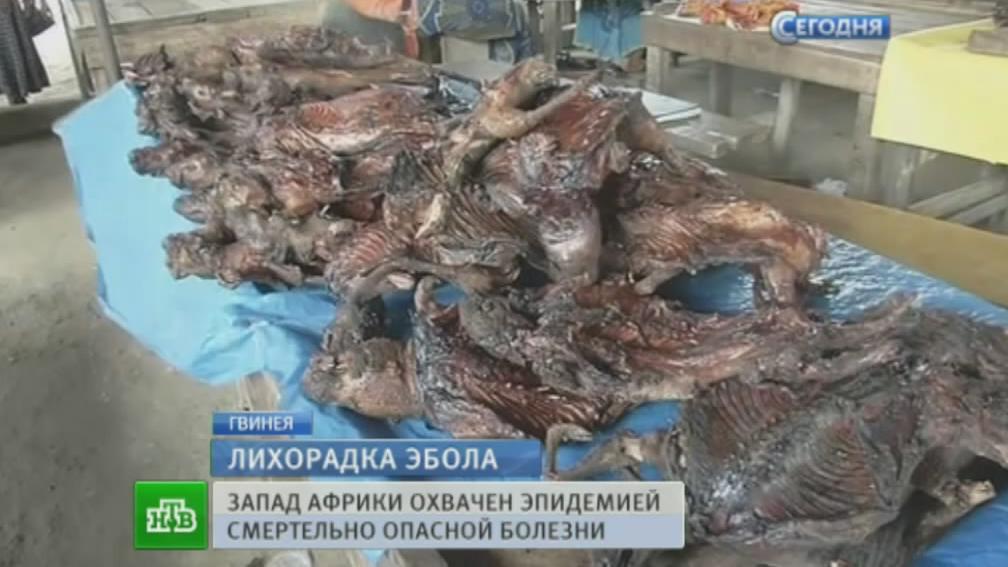 Болит сердце после флюорографии