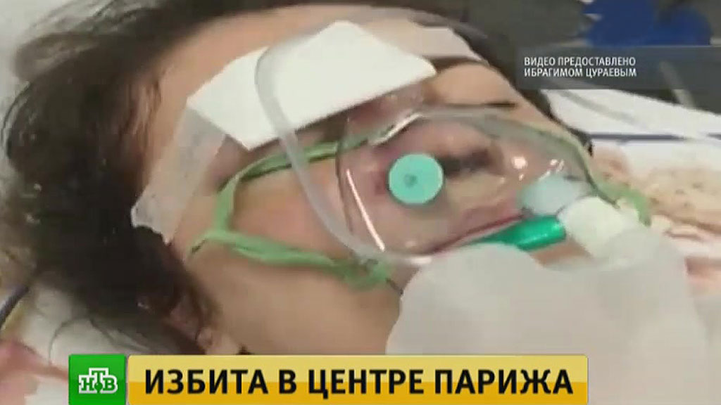 Кровавое месиво: в столице франции неизвестный безжалостно избил русского кинорежиссера Кровавое месиво: в столице франции неизвестный безжалостно избил русского кинорежиссера