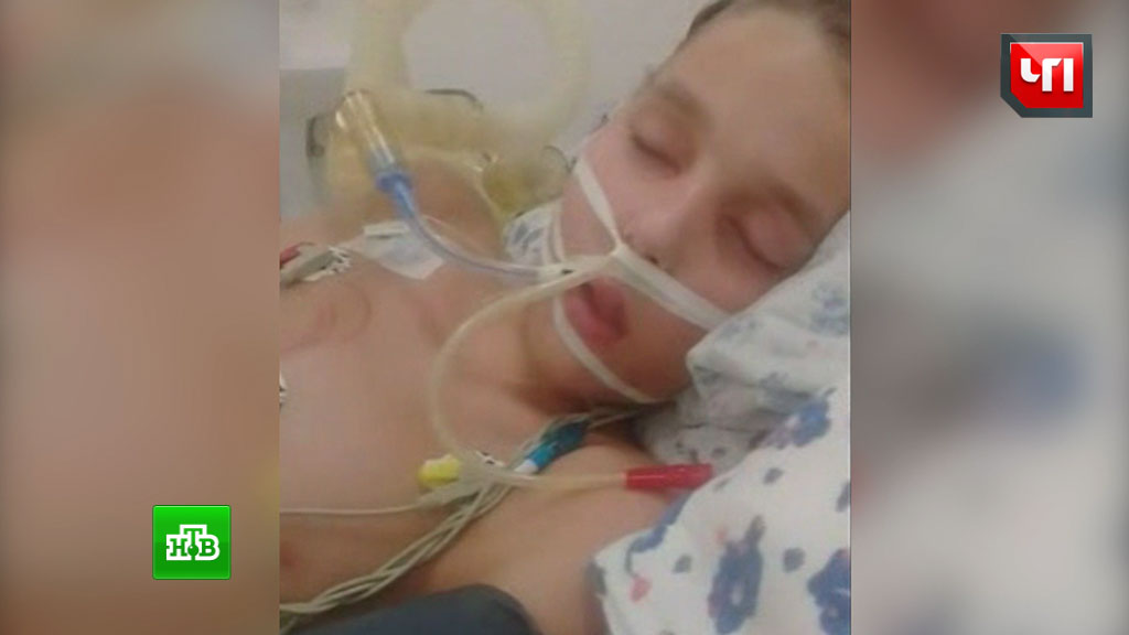 Больной менингитом школьник из Нижневартовска мог впасть в кому по вине врачей
