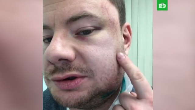 Музыканта DJ Smash жестоко избили в пермском баре.
драки и избиения, музыка и музыканты, Пермь, знаменитости.
НТВ.Ru: новости, видео, программы телеканала НТВ Музыканта DJ Smash жестоко избили в пермском баре.
драки и избиения, музыка и музыканты, Пермь, знаменитости.
НТВ.Ru: новости, видео, программы телеканала НТВ