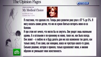 Анджелина джоли что с ней случилось. joli main. Анджелина джоли что с ней случилось фото. Анджелина джоли что с ней случилось-joli main. картинка Анджелина джоли что с ней случилось. картинка joli main