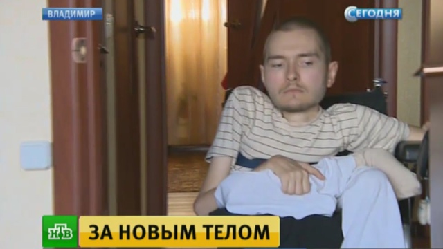Что случилось с человеком которому хотели пересадить голову. Смотреть фото Что случилось с человеком которому хотели пересадить голову. Смотреть картинку Что случилось с человеком которому хотели пересадить голову. Картинка про Что случилось с человеком которому хотели пересадить голову. Фото Что случилось с человеком которому хотели пересадить голову