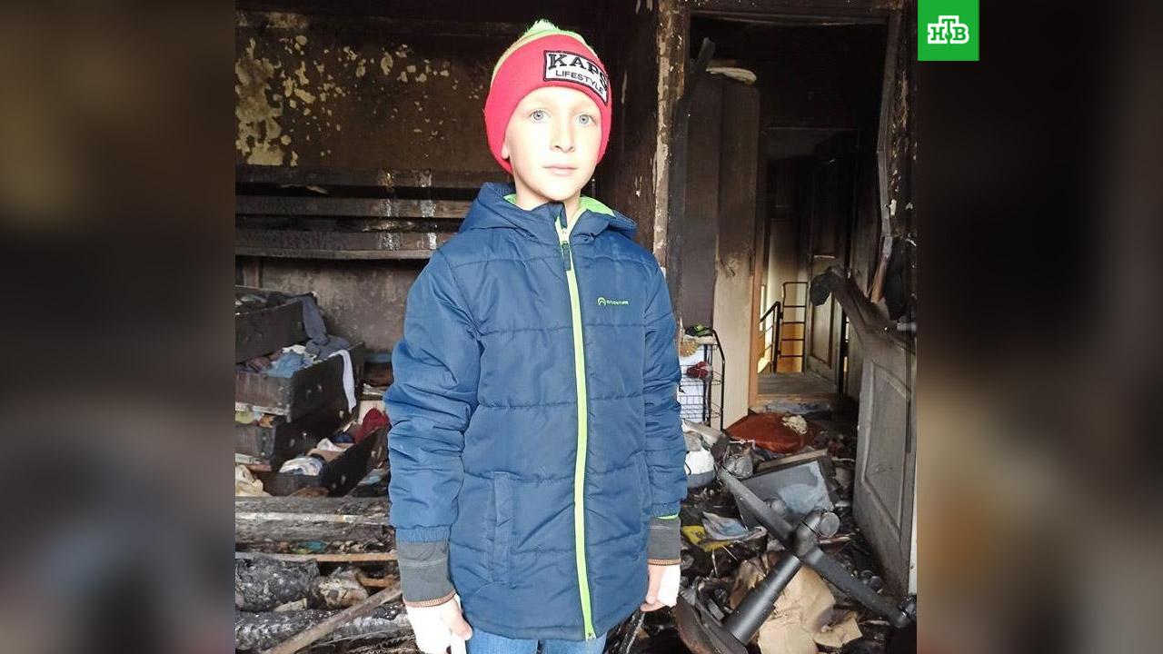 Мальчик со сломанными руками спас сестру при пожаре