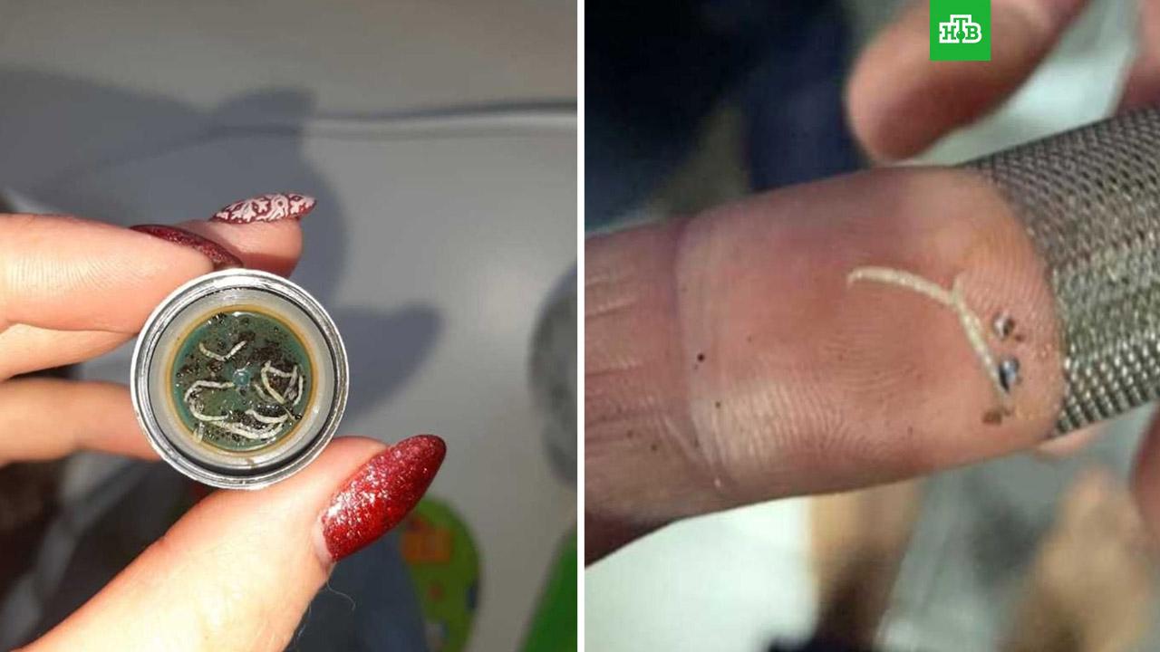 Жители кузбасского города обнаружили в водопроводной воде червей: фото 