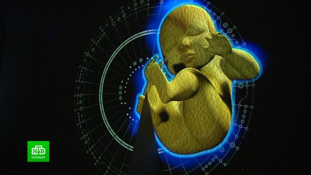 Что случилось с сетью. Смотреть фото Что случилось с сетью. Смотреть картинку Что случилось с сетью. Картинка про Что случилось с сетью. Фото Что случилось с сетью