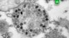 «Вектор» рассказал о жизнеспособности «омикрона» на различных поверхностях коронавирус, эпидемия.НТВ.Ru: новости, видео, программы телеканала НТВ