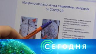 Что случилось с путиным сегодня. Смотреть фото Что случилось с путиным сегодня. Смотреть картинку Что случилось с путиным сегодня. Картинка про Что случилось с путиным сегодня. Фото Что случилось с путиным сегодня